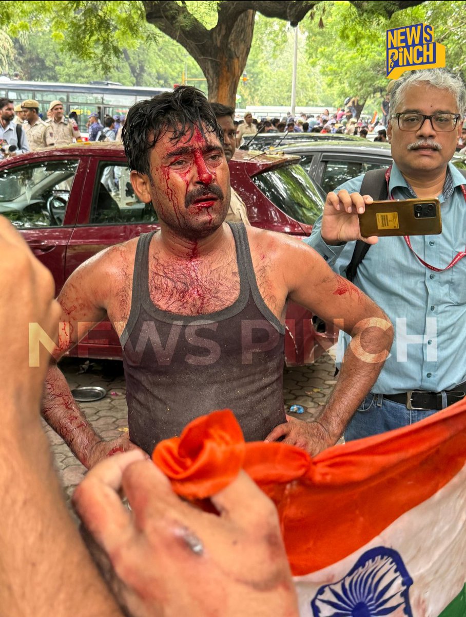 An injured man with blood on his face holds the Indian flag as journalists film
